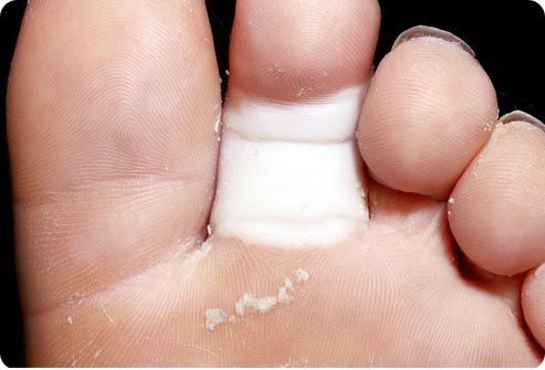 Punca-punca patah jari kaki