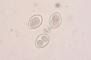 Coccidia - agen penyebab coccidioidosis