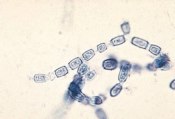 Paracoccidia adalah agen penyebab paracoccidioidosis