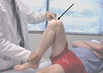 Sakit di lutut semasa fleksi adalah sebab yang paling biasa mengapa orang melawat doktor trauma. 