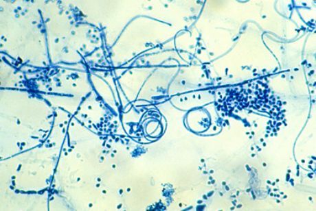 Ejen penyebab epidermophytosis kaki (Trichophyton interdigitale)